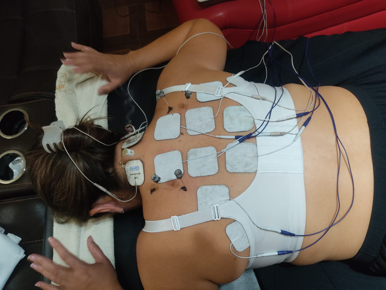 Paciente recibiendo electroterapia con electrodos en la espalda para tratar el dolor